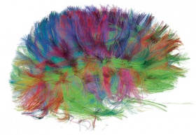 Brain-scan.jpg
